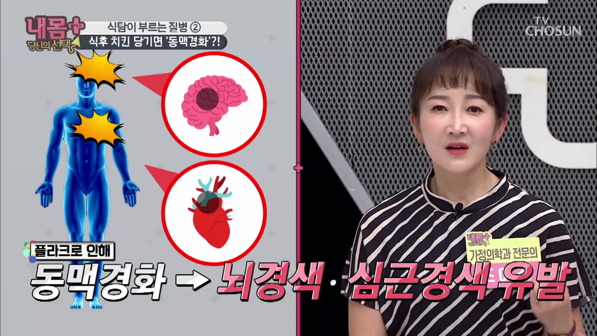 0707 TV조선 내몸플러스 152회.mp4_000479945.png