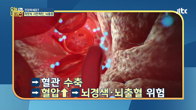 20200110_JTBC 오늘, 굿데이 혈관건강.mp4_001893090.png
