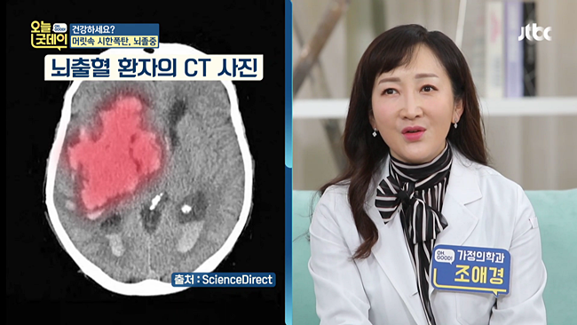 20200110_JTBC 오늘, 굿데이 혈관건강.mp4_001934932.png