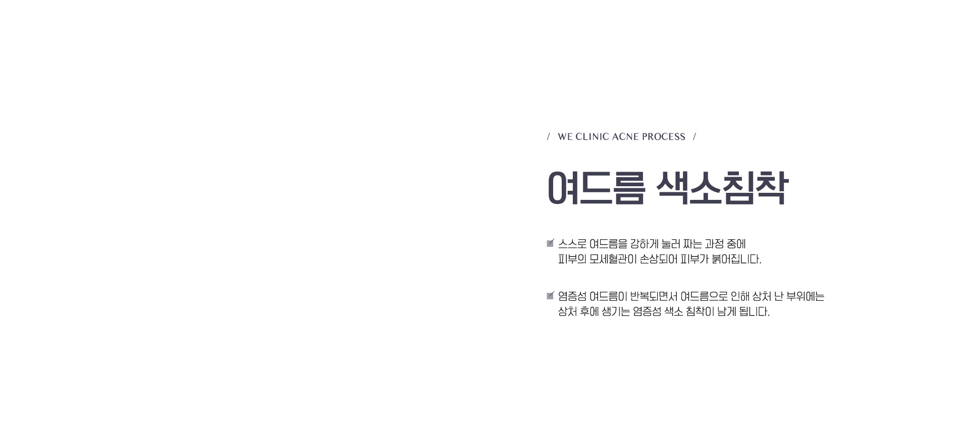 여드름 색소침착